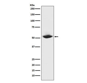 MMP1 Antibody