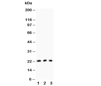 TNFb Antibody