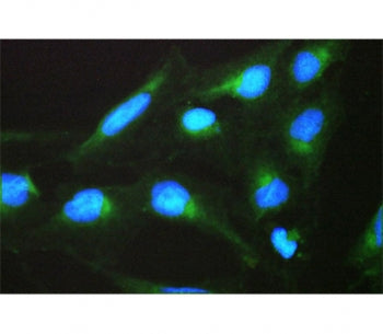 Immunofluorescent staining of FFPE human U-2 OS cells with SPTLC1 antibody (green) and DAPI nuclear 
