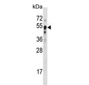 SET7 Antibody / SETD7