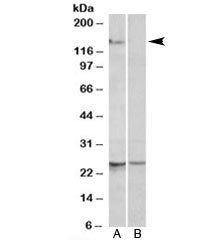 RBM20 Antibody