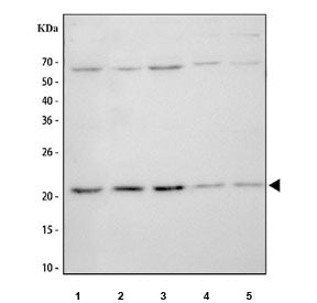 APOBEC3A Antibody / PHO1 / Phorbolin 1