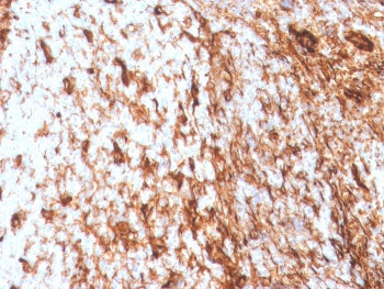 IHC staining of FFPE human tonsil with recombinant Vimentin antibody (clone VIM/4388R). HIER: boil t