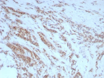 IHC staining of FFPE human prostate tissue with Uropontin antibody (clone rOSP/8856). HIER: boil tis