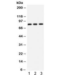 Western blot testing of human 1) SKOV, 2) U87 and 3) PANC cell lysate with CLU antibody. Predicted m