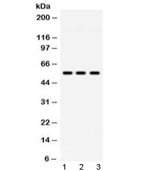 Western blot testing of 1) rat testis, 2) mouse testis and 3) human HeLa lysate with PIAS4 antibody 