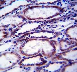 COL1A1 antibody immunohistochemistry analysis in formalin fixed and paraffin embedded human kidney t