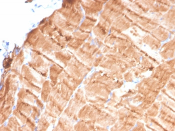 IHC staining of FFPE human skeletal muscle tissue with Tropomyosin antibody (clone TPM1/4510). HIER: