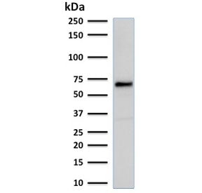 Estrogen Receptor alpha Antibody