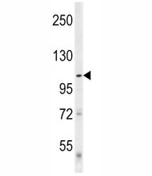 ULK1 Antibody (ATG1)