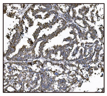 Glutamate-oxaloacetate transaminase 2 Antibody / GOT2 / FABP-1
