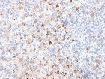 Tyrosinase Antibody