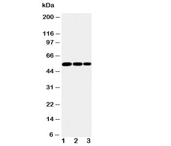 IKK gamma Antibody
