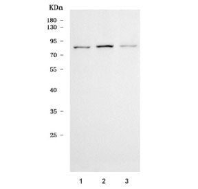 TTLL3 Antibody / Tubulin Tyrosine Ligase Like 3