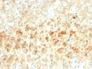 Adipophilin Antibody / Perilipin 2 / ADRP / PLIN2