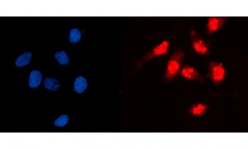 GCKR Antibody / Glucokinase Regulator