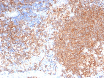 IHC staining of FFPE human tonsil tissue with Polo like kinase 1 antibody (clone PLK1/7122). HIER: b