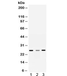 Sorcin Antibody / SRI