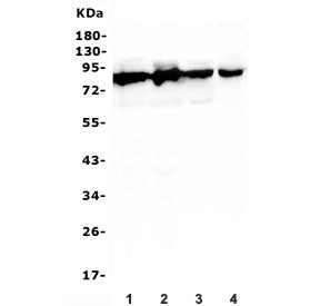 DBH Antibody / Dopamine beta Hydroxylase