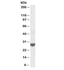 Western blot testing of rat brain lysate with biotinylated Latexin antibody at 0.3ug/ml. Predicted m