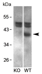 RCAN1 Antibody