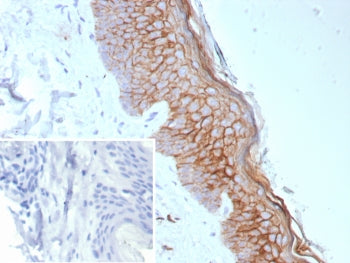 S100A14 Antibody