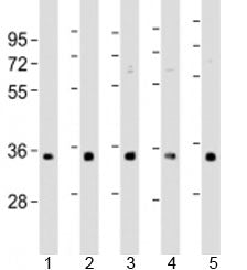 RNPS1 Antibody / LDC2
