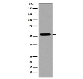 Acetyl-p53 Antibody (Lys370)