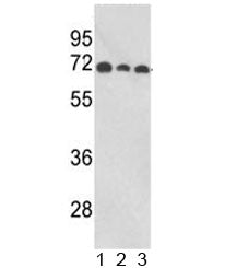 Western blot analysis of ABI1 antibody and human 1) MCF-7, 2) CEM, and 3) Jurkat lysate. Predicted m