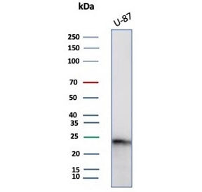 Western blot testing of human U-87 cell lysate with GCSF antibody (clone CSF3/4594). Predicted molec