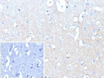 IHC staining of FFPE human brain tissue with recombinant NCAM-L1 antibody (clone L1CAM/9146R). Inset
