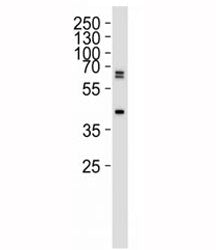 SET07 Antibody