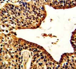 VIP Antibody