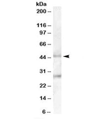 B3GNT2 Antibody