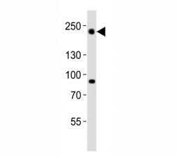 Western blot analysis of lysate from HeLa cell line using Dnmt1 antibody diluted at 1:1000. Predicte