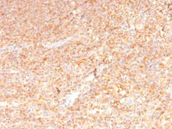IHC staining of FFPE human spleen with GM-CSF antibody (clone CSF2/3402). HIER: boil tissue sections