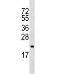 ARF5 Antibody