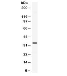 Western blot testing of human HeLa cell lysate with CXCL10 antibody. Expected molecular weight 8~11 