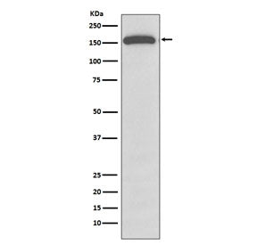 Western blot testing of human A549 cell lysate with GLI1 antibody. Expected molecular weight: 100~16