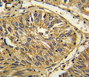 FGFR2 Antibody