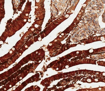 IHC testing of FFPE human duodenum tissue with ADA antibody. HIER: steam section in pH6 citrate buff