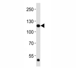 Western blot analysis of lysate from HeLa cell line using FGFR1 antibody at 1:2000. Predicted molecu