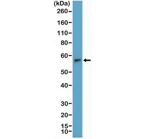 TdT Antibody / Terminal deoxynucleotidyl transferase