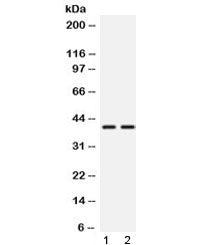 Western blot testing of 1) rat testis and 2) mouse testis lysate with TXNL2 antibody at 0.5ug/ml. Ex