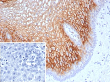 IHC staining of FFPE human esophagus tissue with SBSN antibody (clone SBSN/7963). Inset: PBS used in