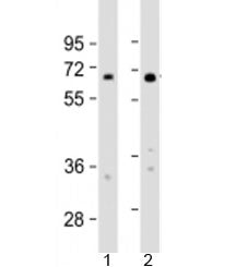 Western blot testing of human 1) HeLa and 2) HT-1080 cell lysate with IL4I1 antibody at 1:2000. Pred