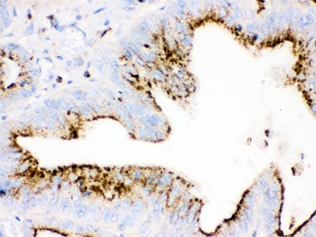 Cathepsin D Antibody