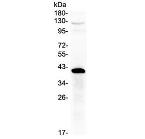 HSD17B1 Antibody