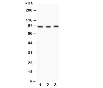 FER Antibody