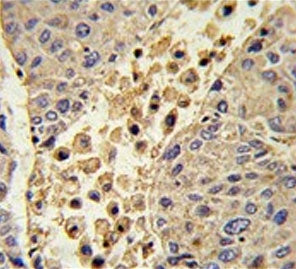 Collectin 11 Antibody / COLEC11